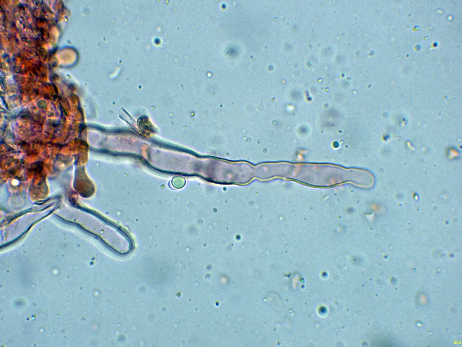 Microscopía de Hypochnicium geogenium - 10 - Cistidio-005